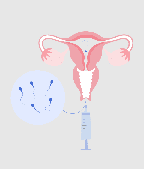 iui