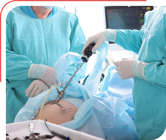 Laparoscopy Treatment in Bangalore